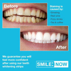 STELLA WHITE LOVE TO SMILE TEETH WHITENING STRIPS - ستيلا وايت لصقات تبييض الأسنان